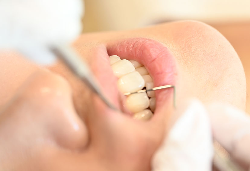 プロービングテクニック